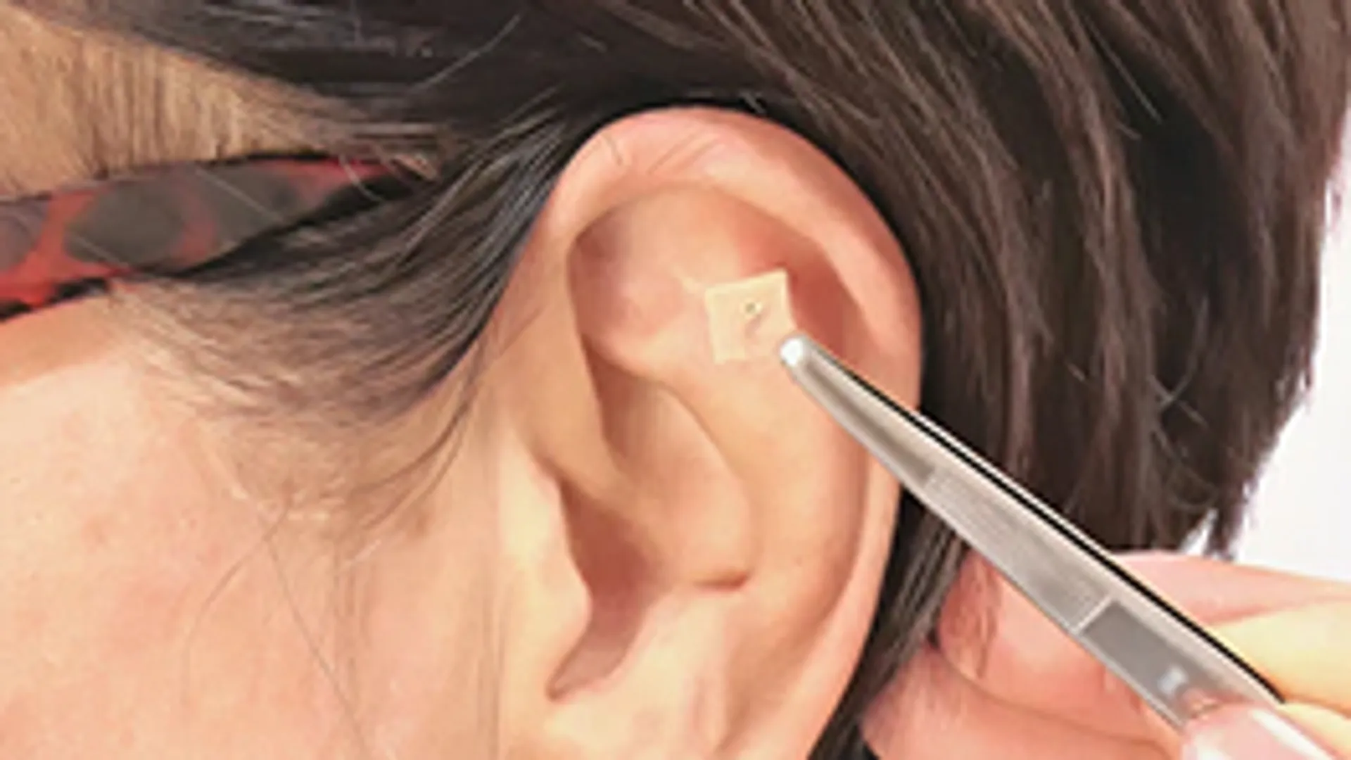 耳つぼ施術を受ける様子